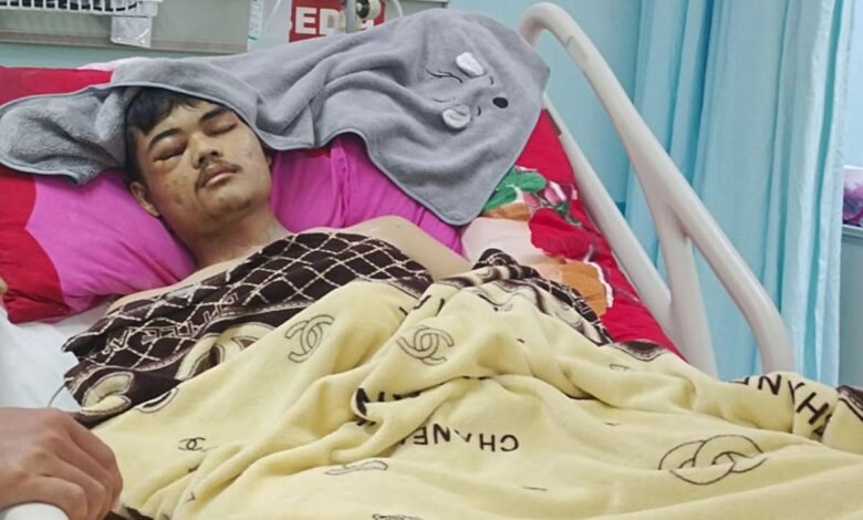 Anemia aplastik: Mari kenali faktor kemudian pengobatannya