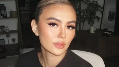 Mengenal Alopecia Areata, Penyakit yang tersebut mana Menjangkit Agnez Mo hingga Alami Kebotakan